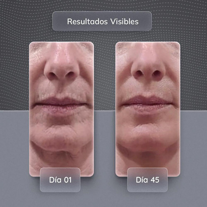 Dispositivo de Rejuvenecimiento Facial | Masajeador Facial de Micro Corriente